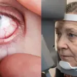 آنکھوں کی بیماری کا علاج، نئی دوا امید کی کرن