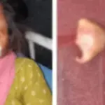 شوہر نے میکے سے واپس نہ آنے پر بیوی کی ناک کاٹ دی