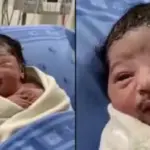 مونچھ والے بچے کی پیدائش نے سب کو حیران کر دیا، ویڈیو وائرل